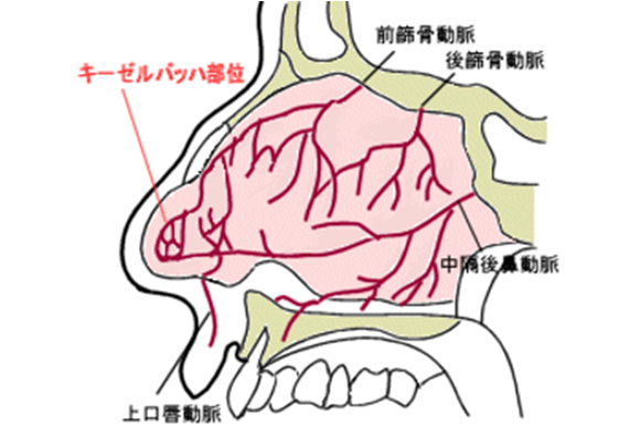 鼻出血