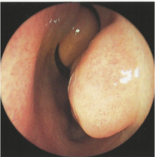 症状01